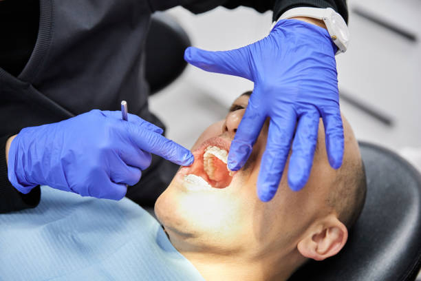 Best Emergency Tooth Extraction in Spiro, OK